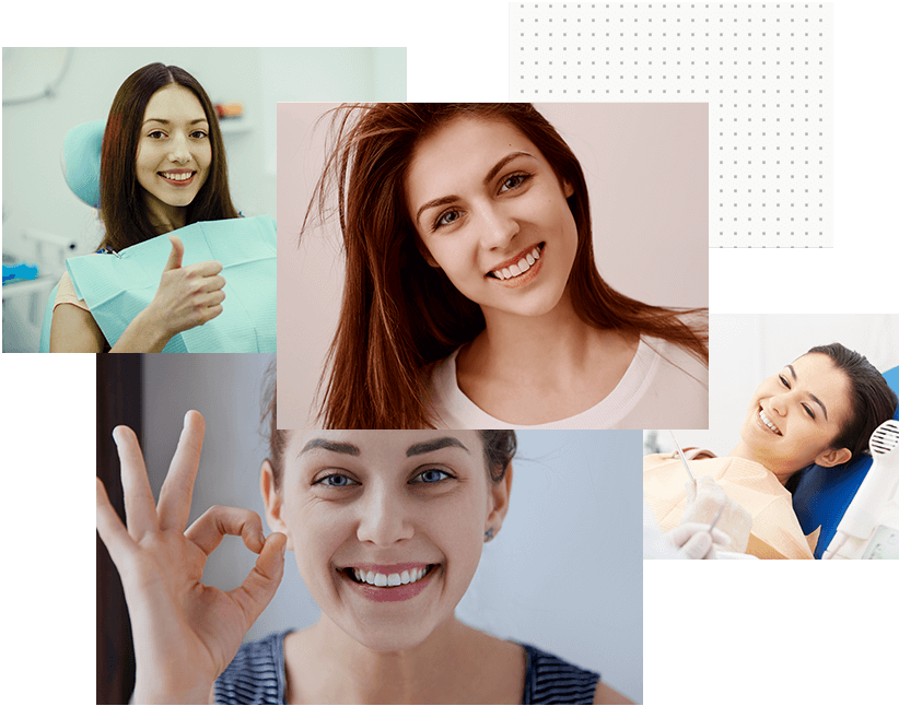 What are Dental Veneers